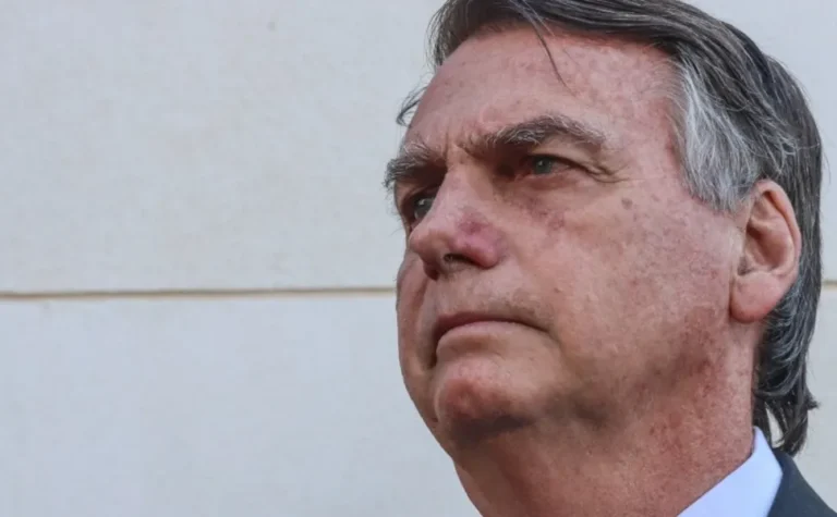 Bolsonaro é diagnosticado com câncer de pele e seguirá sob acompanhamento médico